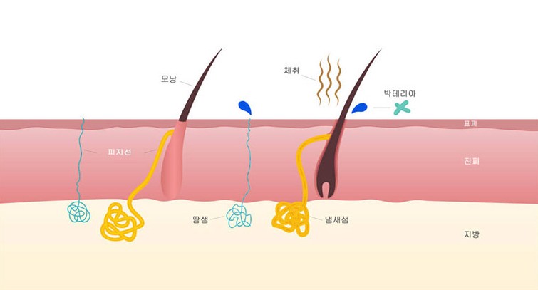 ミラドライの施術メカニズム